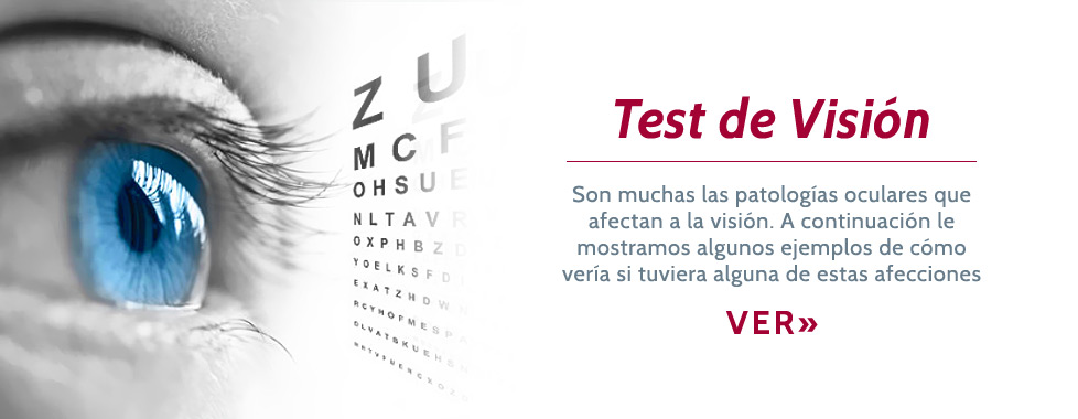 CITO Centro de Investigaciones y Tratamiento Ocular - Oftalmología de Avanzada, Cirugía Refractiva, Cataratas, Retina, Lentes Intraoculares